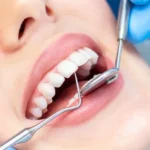 How Cosmetic Dentistry Can Address Chipped or Discolored Teeth