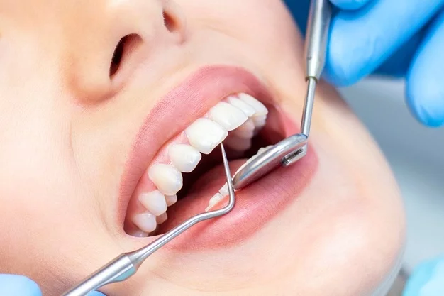 How Cosmetic Dentistry Can Address Chipped or Discolored Teeth