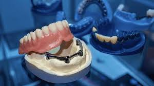 What You Need to Know About Maintaining Dentures