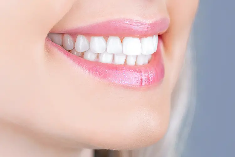 What to Know About At-Home vs. Professional Teeth Whitening