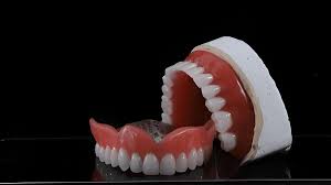 How Are Custom Dentures Made?