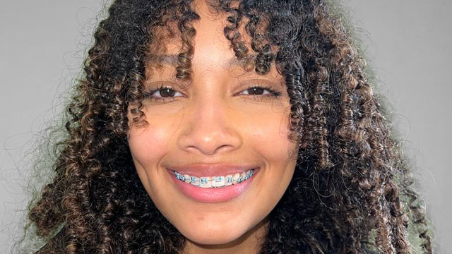 The Role of Braces in Orthodontics for Teens and Adults