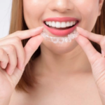 Understanding the Benefits of Invisalign for Adults