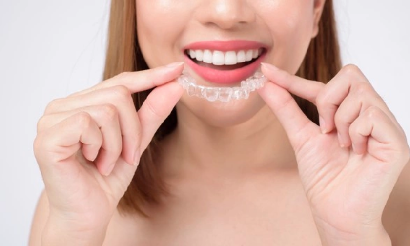 Understanding the Benefits of Invisalign for Adults