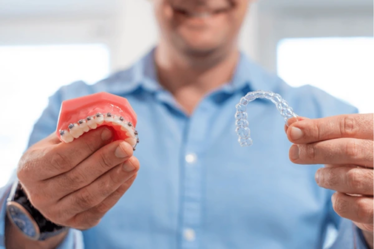 Aligner Vs Braces: Bringing Clarity to The Confusion